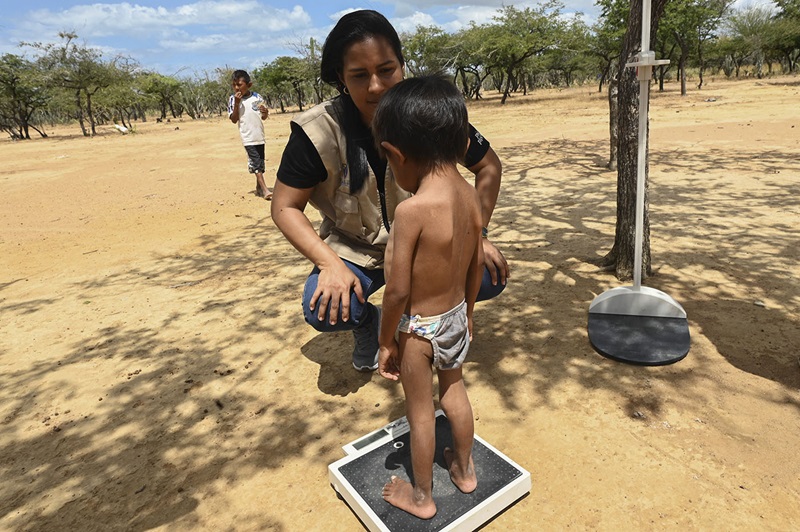 desnutrición infantil en La Guajira