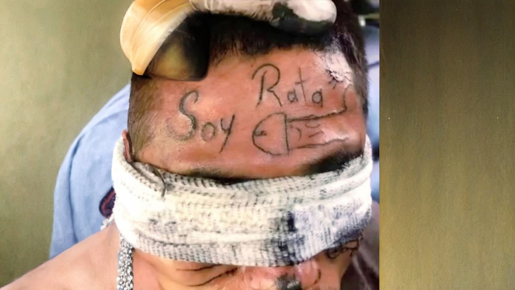 Hombre señalado de robo fue retenido por ciudadanos y marcado en la cara con la frase “soy rata” en Cali